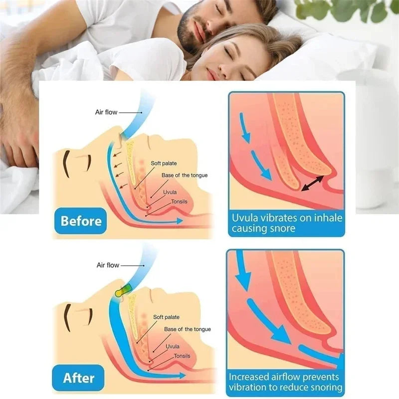 Anti-Snoring Nose Clip